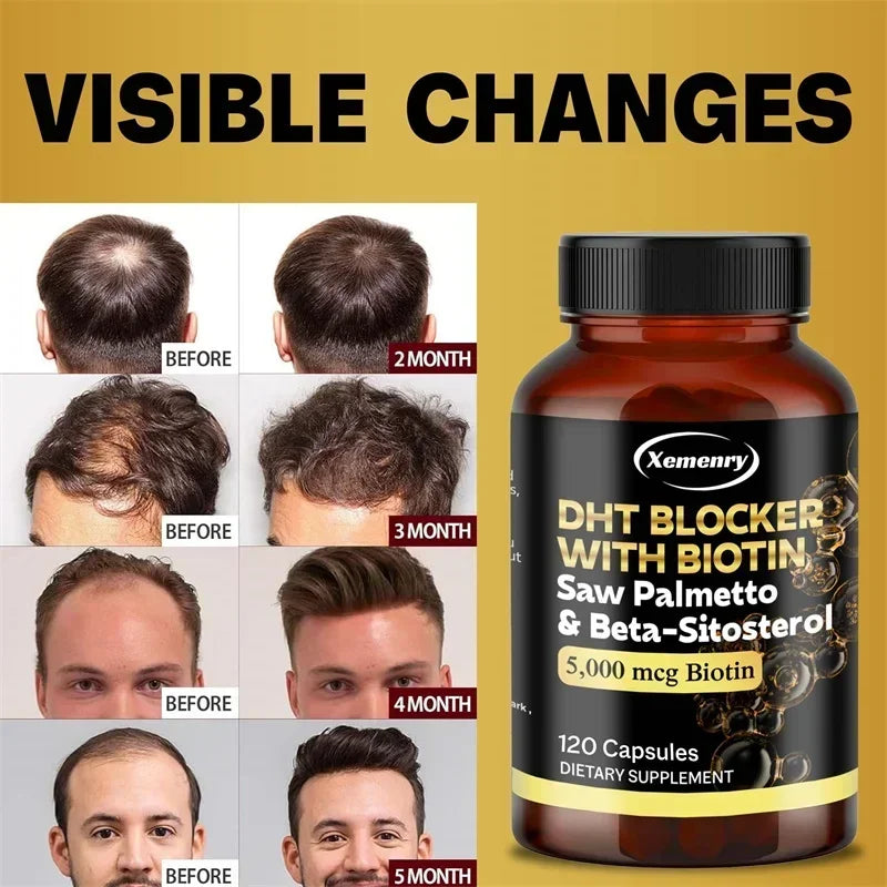 DHT Blocker - Promotes Hair Growth Helps with Healthy Urination Natural DHT Blocker for Men & Women